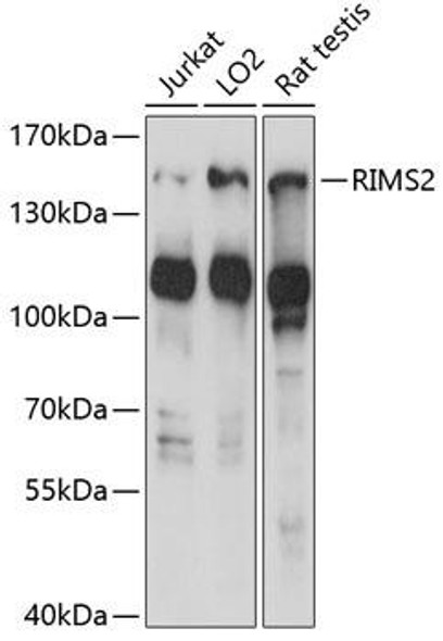 Developmental Biology Anti-RIMS2 Antibody CAB14990