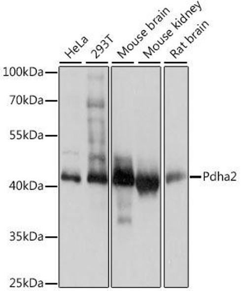 Cell Biology Antibodies 16 Anti-PDHA2 Antibody CAB14994