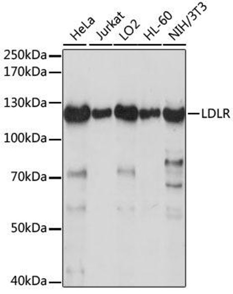 Metabolism Antibodies 1 Anti-LDLR Antibody CAB14996