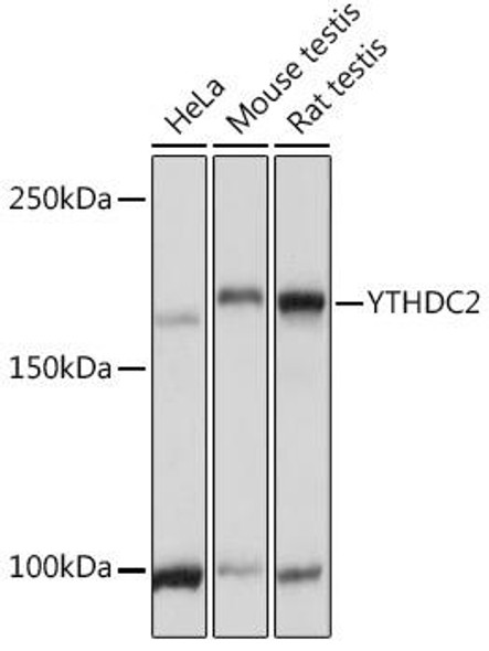 Developmental Biology Anti-YTHDC2 Antibody CAB15004