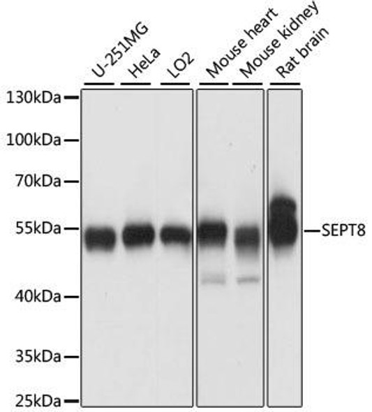 Cell Biology Antibodies 5 Anti-SEPT8 Antibody CAB15011