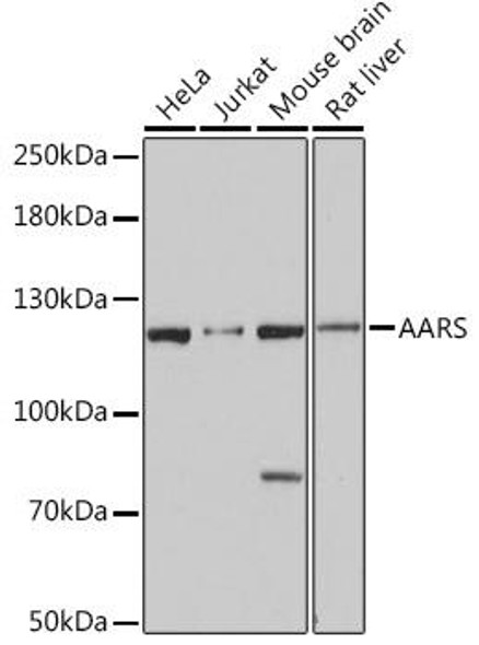 Metabolism Antibodies 1 Anti-AARS Antibody CAB15017