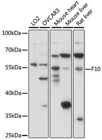 Cardiovascular Antibodies Anti-F10 Antibody CAB15057