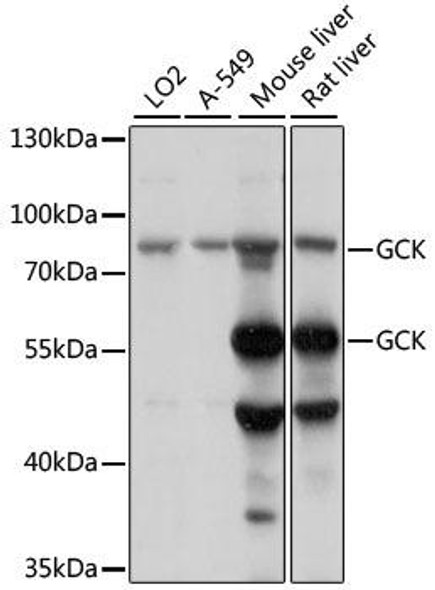 Metabolism Antibodies 1 Anti-GCK Antibody CAB15059