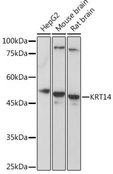 Cell Biology Antibodies 5 Anti-KRT14 Antibody CAB15069