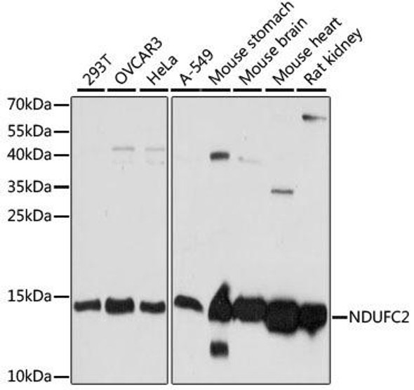 KO Validated Antibodies 1 Anti-NDUFC2 Antibody CAB15073KO Validated