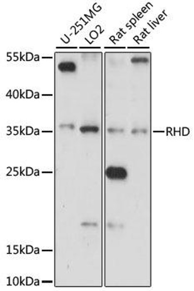 Immunology Antibodies 1 Anti-RHD Antibody CAB15091