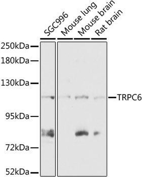 Cell Biology Antibodies 5 Anti-TRPC6 Antibody CAB15107