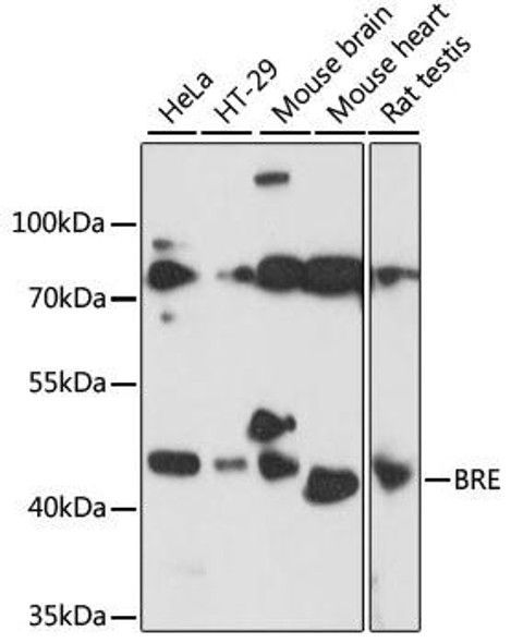 Cell Death Antibodies 1 Anti-BRE Antibody CAB15122