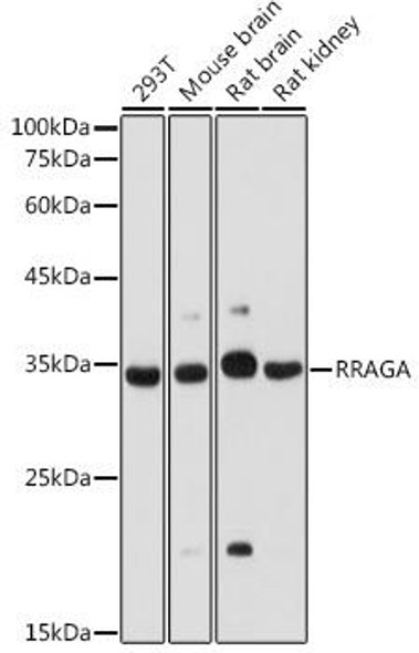 Cell Death Antibodies 1 Anti-RRAGA Antibody CAB15134