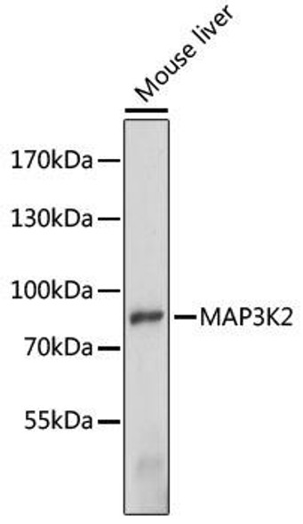 Cell Biology Antibodies 5 Anti-MAP3K2 Antibody CAB15135