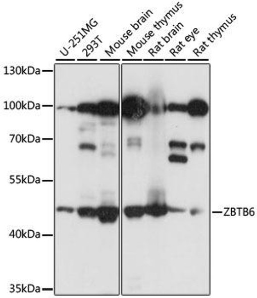 Epigenetics and Nuclear Signaling Antibodies 2 Anti-ZBTB6 Antibody CAB15136
