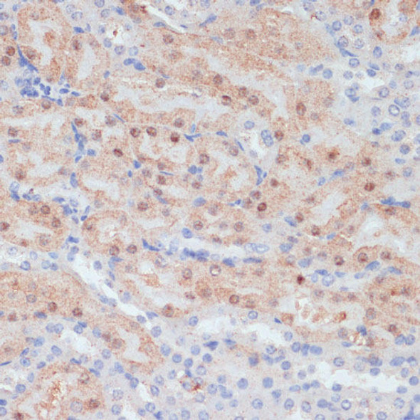 Signal Transduction Antibodies 2 Anti-CLDN17 Antibody CAB15151