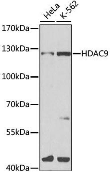 Epigenetics and Nuclear Signaling Antibodies 2 Anti-HDAC9 Antibody CAB1516