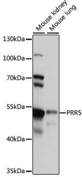 Cell Cycle Antibodies 1 Anti-PRR5 Antibody CAB15170