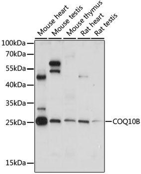 Cell Biology Antibodies 5 Anti-COQ10B Antibody CAB15193