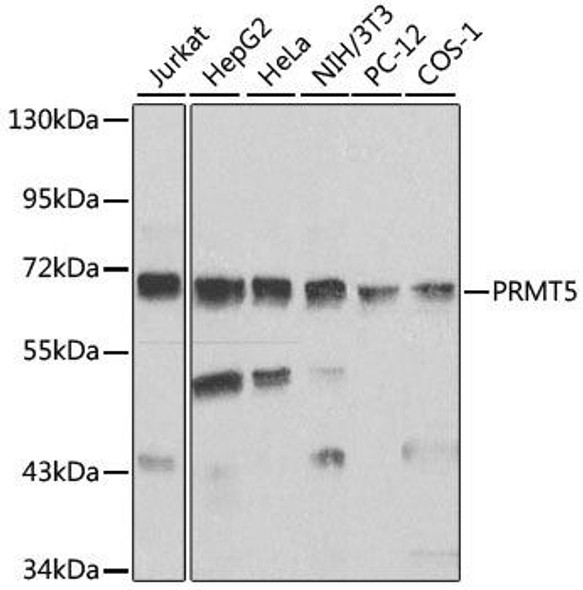 Cell Biology Antibodies 5 Anti-PRMT5 Antibody CAB1520