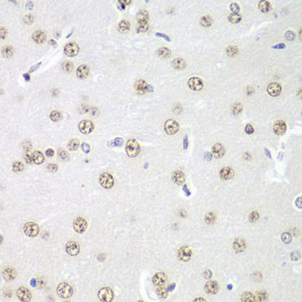 Cell Biology Antibodies 5 Anti-PRMT5 Antibody CAB1520