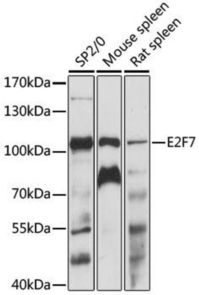 Cell Cycle Antibodies 1 Anti-E2F7 Antibody CAB15211