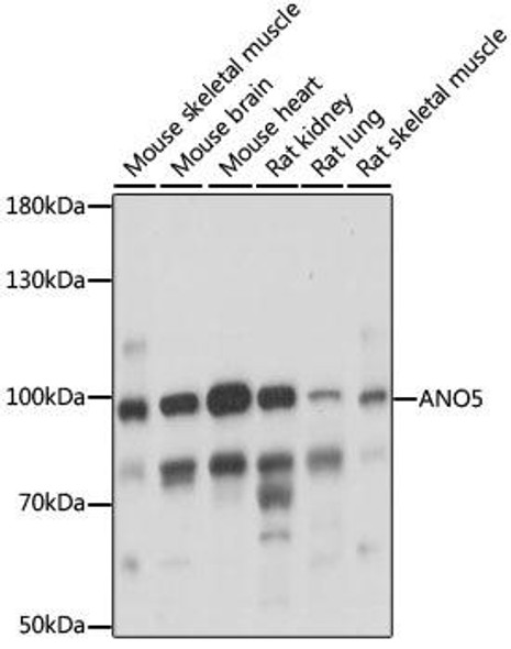 Cell Biology Antibodies 5 Anti-ANO5 Antibody CAB15218