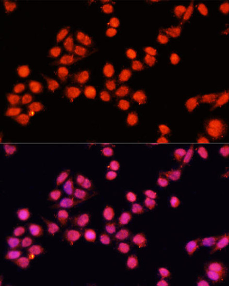 Signal Transduction Antibodies 2 Anti-SLC24A5 Antibody CAB15223