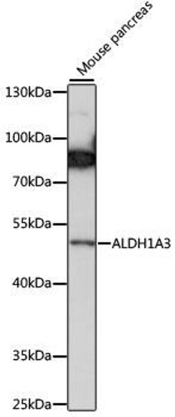 Neuroscience Anti-ALDH1A3 Antibody CAB15230