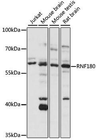 Signal Transduction Antibodies 2 Anti-RNF180 Antibody CAB15241