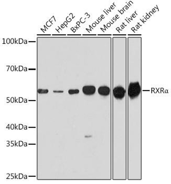 Immunology Antibodies 1 Anti-RXRAlpha Antibody CAB15242