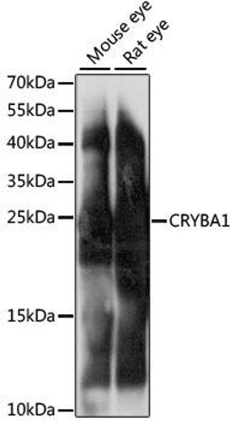Neuroscience Anti-CRYBA1 Antibody CAB15267