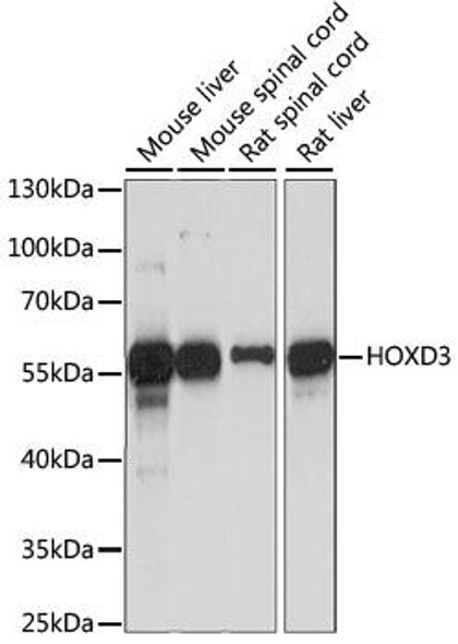 Epigenetics and Nuclear Signaling Antibodies 2 Anti-HOXD3 Antibody CAB15279