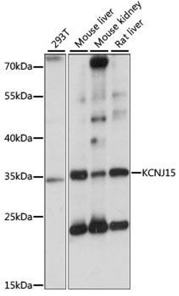 Signal Transduction Antibodies 2 Anti-KCNJ15 Antibody CAB15282