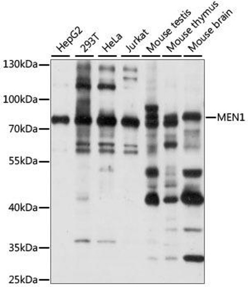 Epigenetics and Nuclear Signaling Antibodies 2 Anti-MEN1 Antibody CAB15290