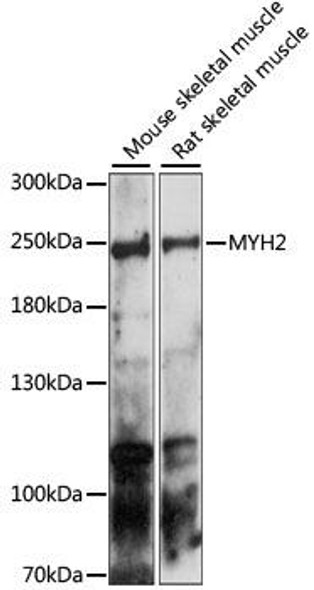 Cell Biology Antibodies 5 Anti-MYH2 Antibody CAB15292