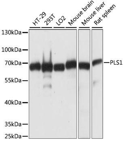 Cell Biology Antibodies 5 Anti-PLS1 Antibody CAB15303