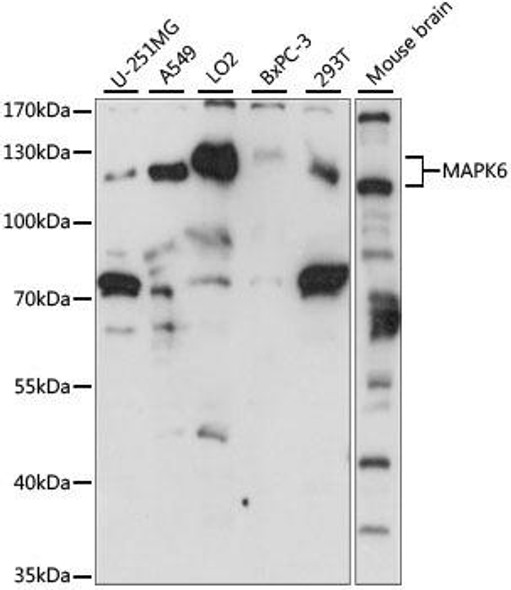 KO Validated Antibodies 1 Anti-MAPK6 Antibody CAB15304KO Validated