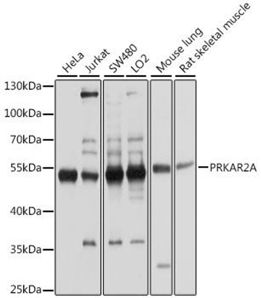 KO Validated Antibodies 1 Anti-PRKAR2A Antibody CAB1531KO Validated