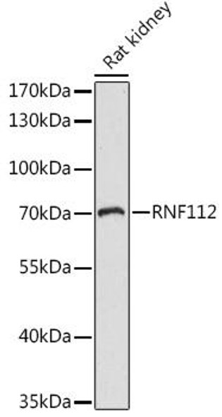 Neuroscience Anti-RNF112 Antibody CAB15333