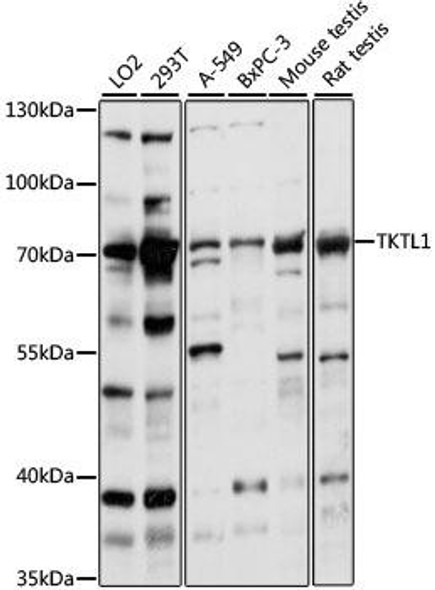 Cell Biology Antibodies 6 Anti-TKTL1 Antibody CAB15337