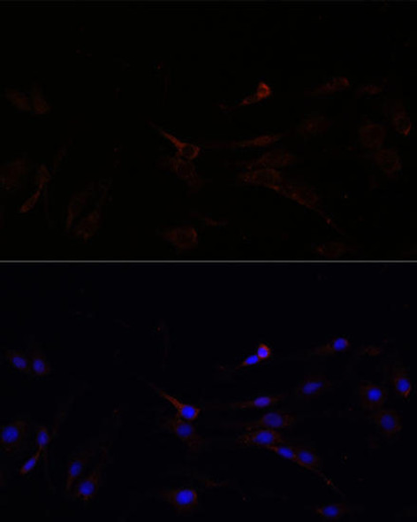 Metabolism Antibodies 1 Anti-SUCLG1 Antibody CAB15345