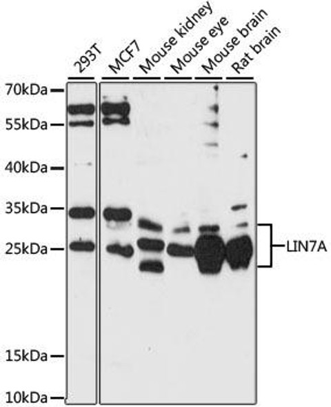 Cell Biology Antibodies 6 Anti-LIN7A Antibody CAB15346