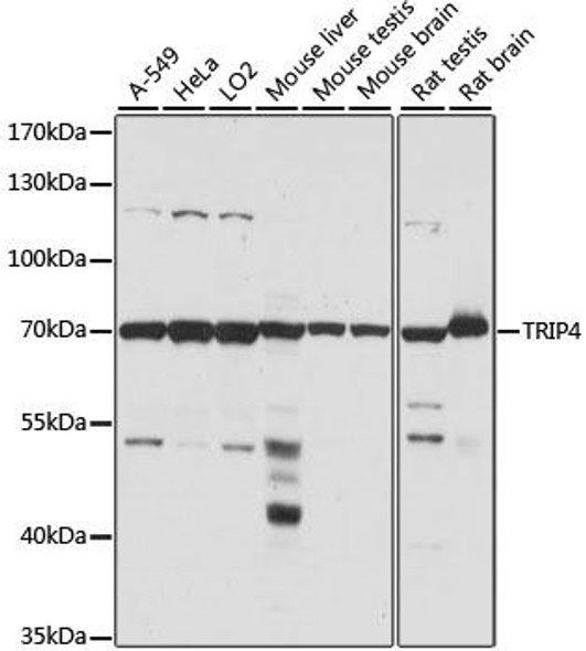 Epigenetics and Nuclear Signaling Antibodies 2 Anti-TRIP4 Antibody CAB15352