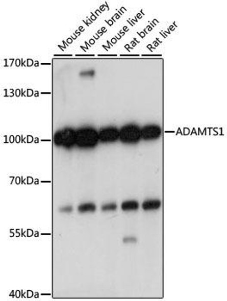 Cell Biology Antibodies 6 Anti-ADAMTS1 Antibody CAB15356