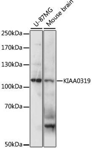 Neuroscience Anti-KIAA0319 Antibody CAB15369