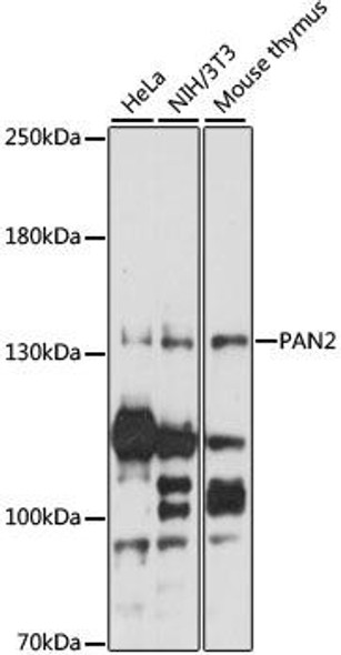 Epigenetics and Nuclear Signaling Antibodies 2 Anti-PAN2 Antibody CAB15373