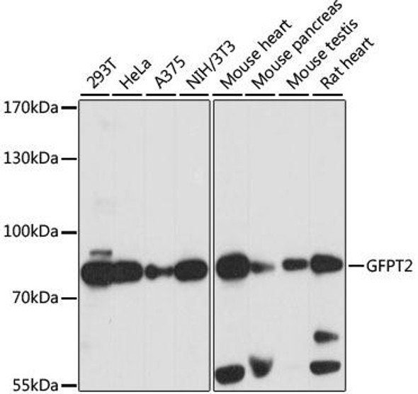 Cell Biology Antibodies 6 Anti-GFPT2 Antibody CAB15374