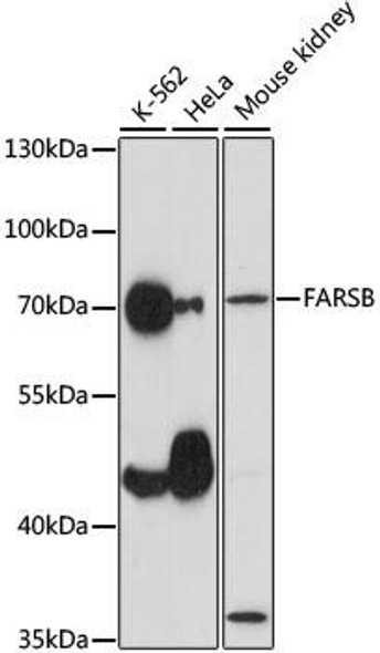 Metabolism Antibodies 1 Anti-FARSB Antibody CAB15375