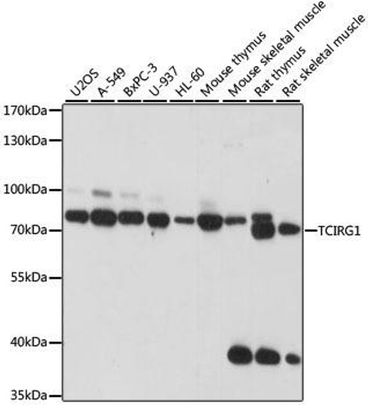 Signal Transduction Antibodies 2 Anti-TCIRG1 Antibody CAB15382