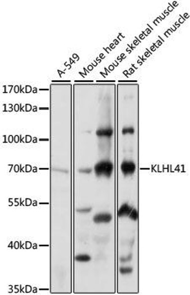 Cell Biology Antibodies 6 Anti-KLHL41 Antibody CAB15383