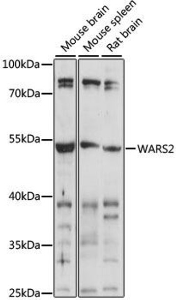 Metabolism Antibodies 1 Anti-WARS2 Antibody CAB15384