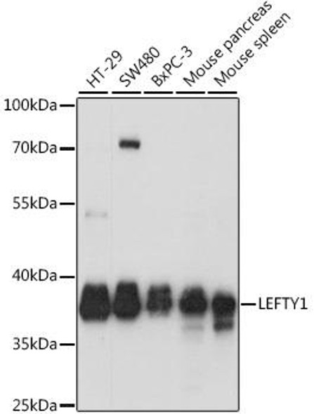 Cell Biology Antibodies 16 Anti-LEFTY1 Antibody CAB15389